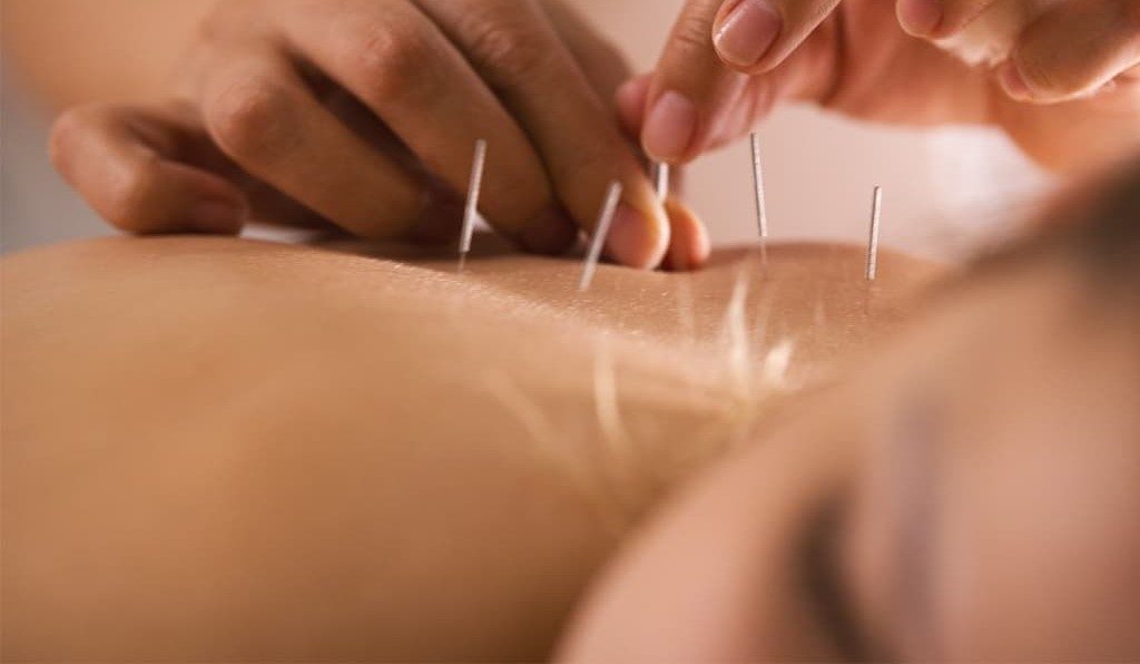 CE Course Approved by Acupuncture Board (Samra Institute)